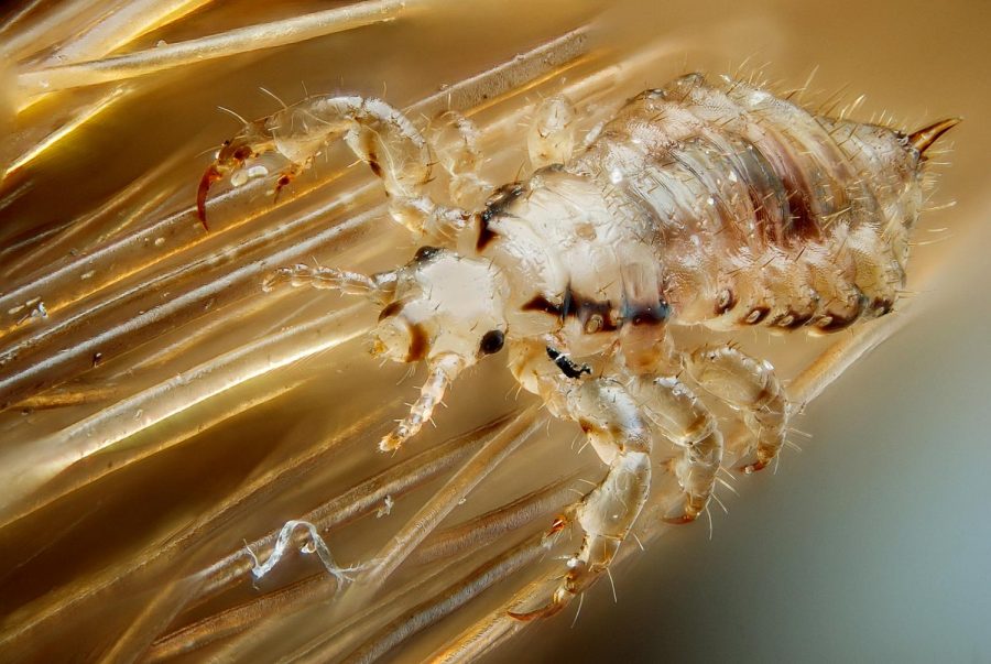Potential head lice outbreak leads to public health notice