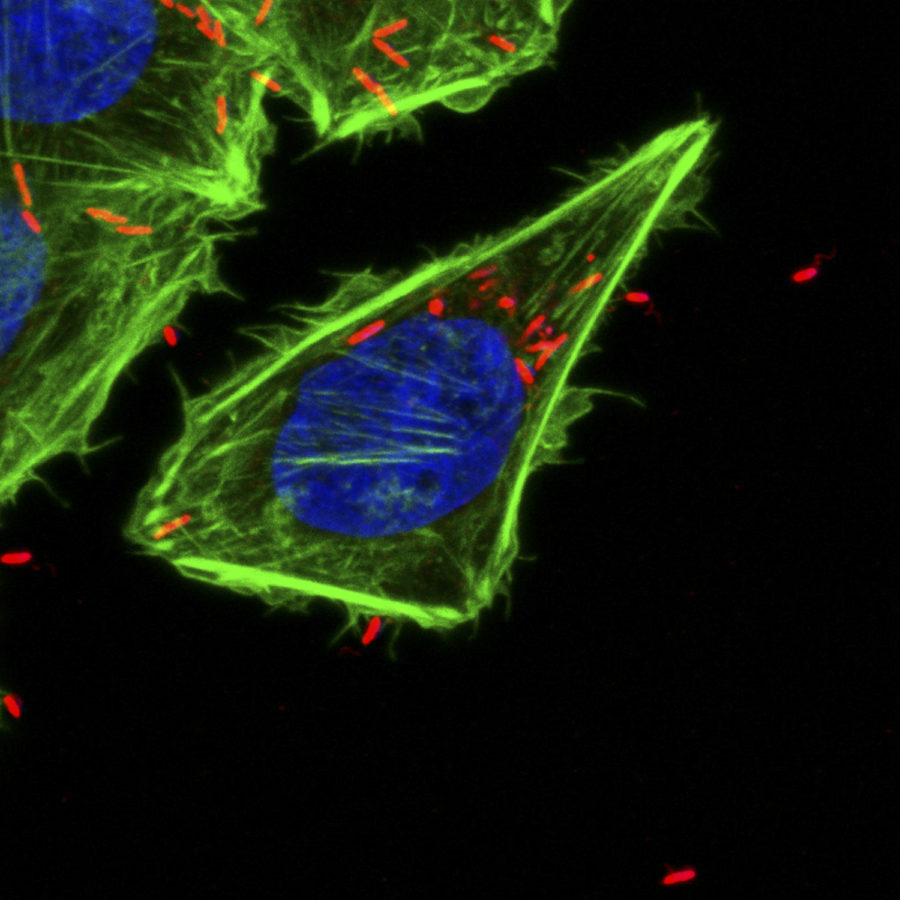 An intestinal cell is infected by Campylobacter jejuni, a bacterium that causes food-borne illness. The bacteria are red, and the host cell is green.